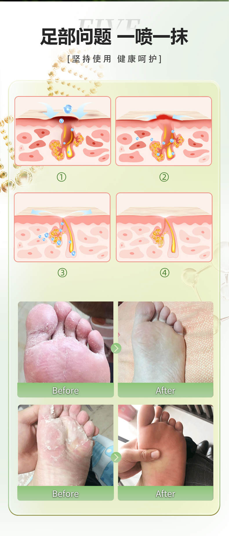 佰世修康脚气保健液/膏