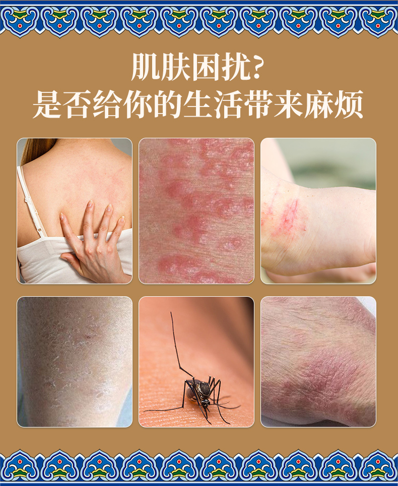 湿痒清 止痒保健膏